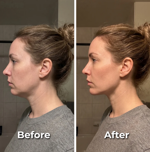 Lymphatic drainage brush