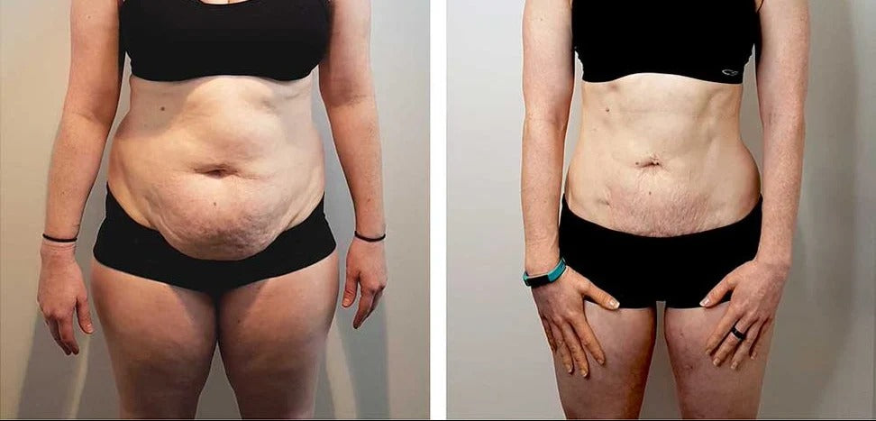 LOOSE SKIN